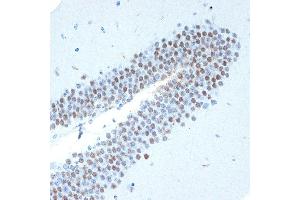 Immunohistochemistry of paraffin-embedded mouse brain using CHD3 Rabbit mAb (ABIN7266363) at dilution of 1:100 (40x lens).