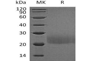 Western Blotting (WB) image for Cytotoxic T-Lymphocyte-Associated Protein 4 (CTLA4) protein (DYKDDDDK Tag) (ABIN7320508)