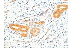 ABIN6267070 at 1/100 staining rat uterine tissue sections by IHC-P.