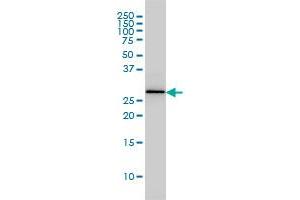 PSME2 monoclonal antibody (M02), clone 1G4 Western Blot analysis of PSME2 expression in MCF-7 .