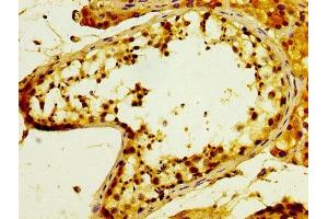 anti-Protein O-Fucosyltransferase 2 (POFUT2) (AA 125-271) antibody