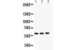 Anti-CYP11A1 antibody, Western blottingAll lanes: Anti CYP11A1  at 0.