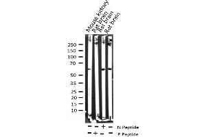 Western blot analysis of Phospho-Myc (Thr58) expression in various lysates (c-MYC anticorps  (pThr58))