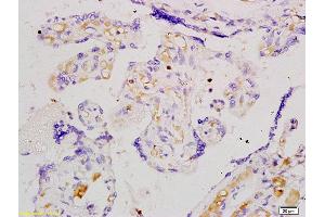 Formalin-fixed and paraffin embedded human placenta tissue labeled with Anti-Angiomotin Polyclonal Antibody, Unconjugated (ABIN754873) at 1:200 followed by conjugation to the secondary antibody and DAB staining