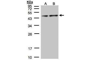 WB Image Sample(30 μg of whole cell lysate) A:Hep G2, B:MOLT4, 12% SDS PAGE antibody diluted at 1:1000 (Pyruvate Dehydrogenase E1 alpha (Center) anticorps)