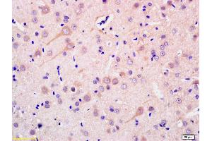 Formalin-fixed and paraffin embedded rat brain labeled with Anti-ADCY1 Polyclonal Antibody, Unconjugated (ABIN702565) at 1:200 followed by conjugation to the secondary antibody and DAB staining. (ADCY1 anticorps  (AA 751-850))