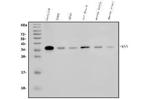 Western blot analysis of HOXC8 using anti-HOXC8 antibody (ABIN7600248).