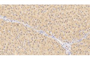 Detection of F12 in Human Liver Tissue using Polyclonal Antibody to Coagulation Factor XII (F12)