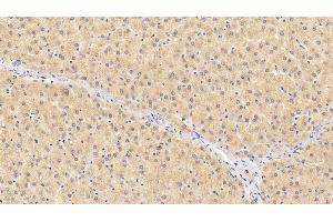 Detection of F12 in Human Liver Tissue using Polyclonal Antibody to Coagulation Factor XII (F12) (F12 anticorps  (AA 400-615))