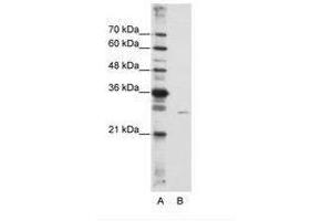 Image no. 2 for anti-EMG1 Nucleolar Protein Homolog (EMG1) (AA 51-100) antibody (ABIN6736233) (EMG1 anticorps  (AA 51-100))