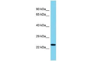 Host: Rabbit Target Name: IL34 Sample Type: U937 Whole Cell lysates Antibody Dilution: 1. (IL-34 anticorps  (N-Term))
