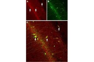 Expression of CACNB3 (CaVβ3) in rat hippocampus - Immunohistochemical staining of rat hippocampus with Anti-CACNB3 Antibody (ABIN7042987, ABIN7043959 and ABIN7043960).