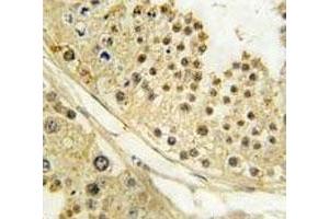 IHC analysis of FFPE human testis tissue stained with Aurora B antibody (Aurora Kinase B anticorps  (AA 6-35))