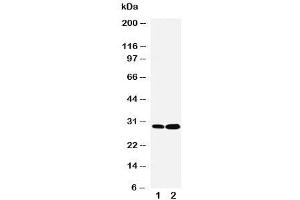 Western blot testing of LASP1 antibody and Lane 1:  HeLa (LASP1 anticorps  (C-Term))