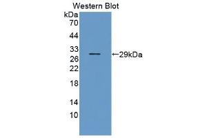 Detection of Recombinant LOX1, Bovine using Polyclonal Antibody to Lectin Like Oxidized Low Density Lipoprotein Receptor 1 (LOX1) (OLR1 anticorps  (AA 57-270))