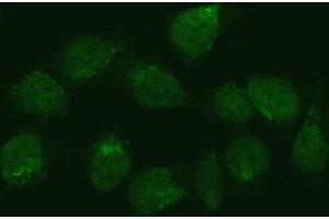 IF analysis of ZMYND8 using anti-ZMYND8 antibody (ABIN7598947).