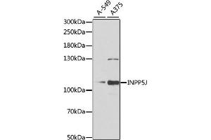 Western blot analysis of extracts of various cell lines, using INPP5J antibody (ABIN6132490, ABIN6142471, ABIN6142472 and ABIN6222324) at 1:1000 dilution. (INPP5J anticorps  (AA 60-360))