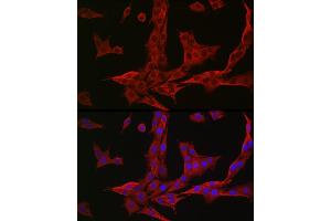 Immunofluorescence analysis of PC-12 cells using NQO1 Rabbit pAb (ABIN1681096, ABIN3015018, ABIN3015019 and ABIN6213595) at dilution of 1:50 (40x lens).