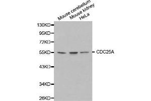 Western blot analysis of extracts of various cell lines, using CDC25A antibody. (CDC25A anticorps  (AA 235-484))