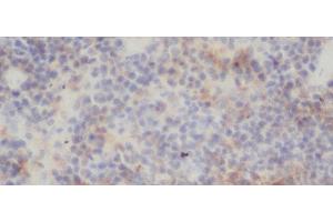 Immunohistochemistry of paraffin-embedded Rat spleen using RELB Polyclonal Antibody at dilution of 1:50 (RELB anticorps)