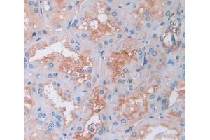 Used in DAB staining on fromalin fixed paraffin- embedded kidney tissue (Tec Protein Tyrosine Kinase (TEC) (AA 370-623) anticorps)