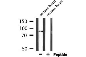 Western blot analysis of extracts from mouse heart, using NEB2 Antibody. (PPP1R9B anticorps  (C-Term))