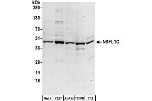 anti-NSFL1 (p97) Cofactor (p47) (NSFL1C) (AA 25-75) antibody