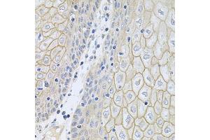 Immunohistochemistry of paraffin-embedded human esophagus using NCR3 antibody (ABIN5974302) at dilution of 1/100 (40x lens). (NCR3 anticorps)