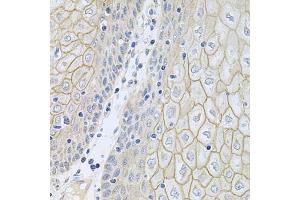 Immunohistochemistry of paraffin-embedded human esophagus using NCR3 antibody (ABIN5974302) at dilution of 1/100 (40x lens).