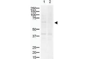 Image no. 1 for anti-ZIC2 (ZIC2) (AA 189-206) antibody (ABIN401287) (ZIC2 anticorps  (AA 189-206))
