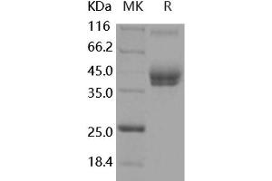 Western Blotting (WB) image for Activated Leukocyte Cell Adhesion Molecule (ALCAM) (Active) protein (His tag,Fc Tag) (ABIN7320443)