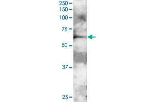 GRB7 polyclonal antibody  staining (2 ug/mL) of A-431 lysate (RIPA buffer, 30 ug total protein per lane). (GRB7 anticorps)