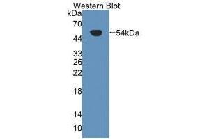 Detection of Recombinant Kim1, Human using Polyclonal Antibody to Kidney Injury Molecule 1 (Kim1) (HAVCR1 anticorps  (AA 21-240))