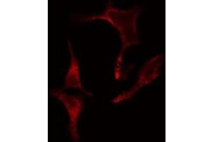ABIN6275641 staining LOVO cells by IF/ICC. (EIF2B4 anticorps  (Internal Region))