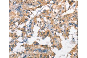 Immunohistochemistry (IHC) image for anti-Scavenger Receptor Class B, Member 1 (SCARB1) antibody (ABIN2421655) (SCARB1 anticorps)