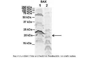 Lanes:   1. (BAX anticorps  (N-Term))