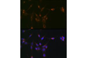 anti-PDZ and LIM Domain 1 (PDLIM1) antibody
