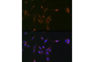 Immunofluorescence analysis of NIH/3T3 cells using PDLIM1/CLP36 Rabbit mAb (ABIN7269195) at dilution of 1:100 (40x lens). (PDLIM1 anticorps)