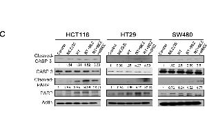 BEZ235 maintenance treatment following RT + BEZ235 treatment resulted in significantly less cell survival and more apoptosis markers in CRC cells.
