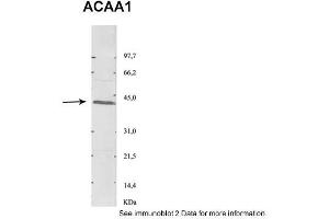 Sample Type: 1. (ACAA1 anticorps  (N-Term))