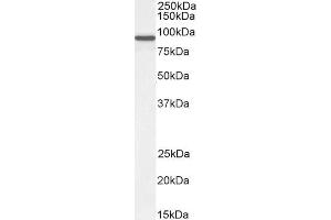 ABIN185097 (0. (Centaurin beta 2 anticorps  (C-Term))