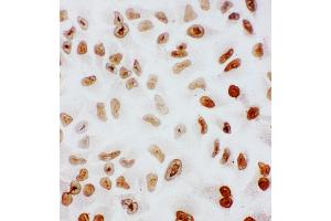 Anti-splicing factor 1 antibody, ICC ICC: HELA Cell