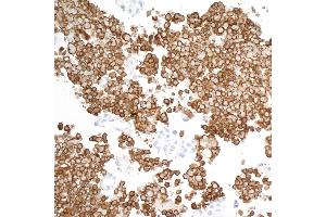 Immunohistochemistry (IHC) image for anti-CD163 (CD163) (AA 850-900) antibody (ABIN7448890)