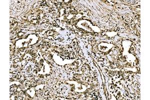 IHC analysis of WAPL/FOE using anti-WAPL/FOE antibody (ABIN7602663). (WAPAL anticorps  (AA 916-1190))