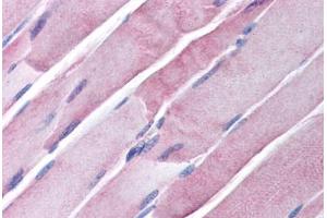 Human Skeletal Muscle (formalin-fixed, paraffin-embedded) stained with GOT2 antibody ABIN291150 at 20 ug/ml followed by biotinylated secondary antibody, alkaline phosphatase-streptavidin and chromogen. (GOT1 anticorps)