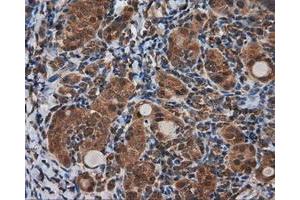 Immunohistochemical staining of paraffin-embedded Kidney tissue using anti-KIAA1609 mouse monoclonal antibody. (KIAA1609 anticorps)
