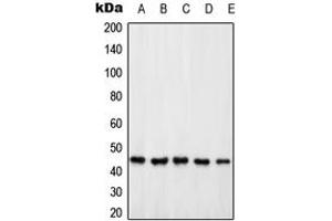 Western blot analysis of PSMD6 expression in HeLa (A), Jurkat (B), HEK293T (C), SP2/0 (D), PC12 (E) whole cell lysates.