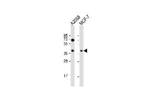 All lanes : Anti-GNA12 Antibody (S67) at 1:1000 dilution Lane 1:  whole cell lysate Lane 2: MCF-7 whole cell lysate Lysates/proteins at 20 μg per lane. (GNA12 anticorps  (AA 46-75))