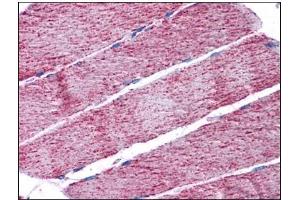 Human Skeletal Muscle: Formalin-Fixed, Paraffin-Embedded (FFPE) (FH anticorps  (Internal Region))