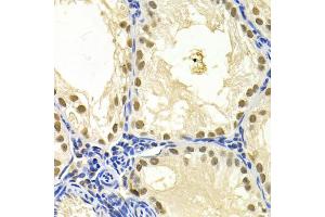 Immunohistochemistry of paraffin-embedded mouse testis using DDB1 Antibody (ABIN5971498) at dilution of 1/200 (40x lens). (DDB1 anticorps)
